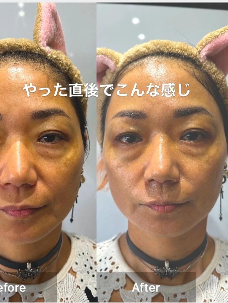 画像10028