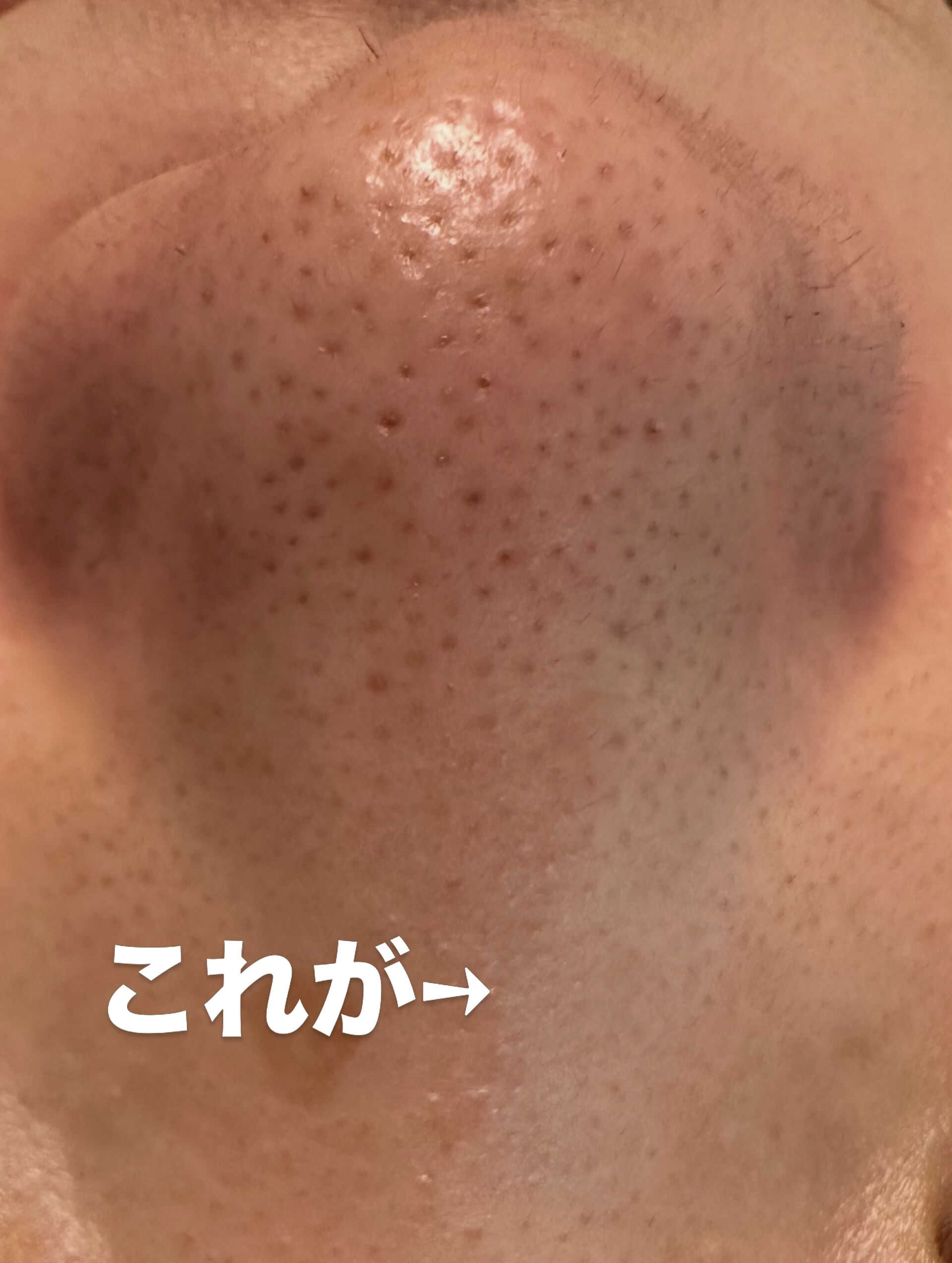 「毛穴、なんかもう諦めてた」