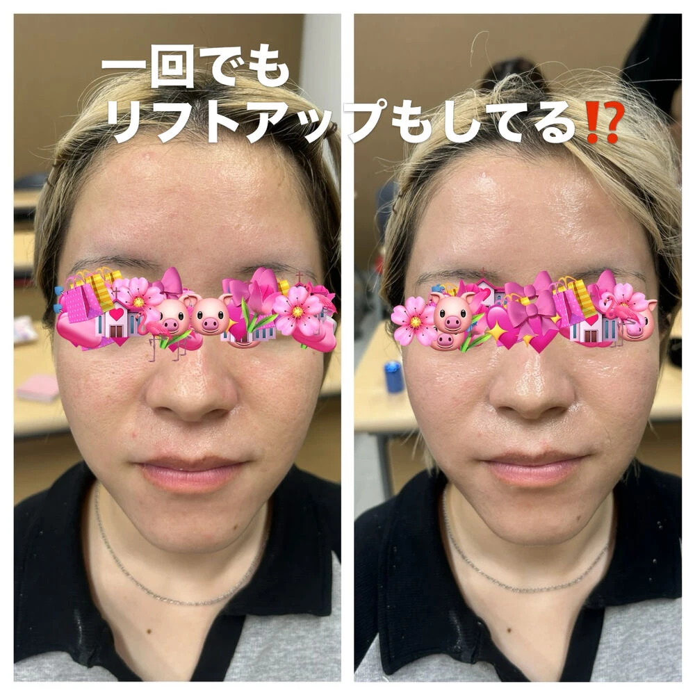 画像10290