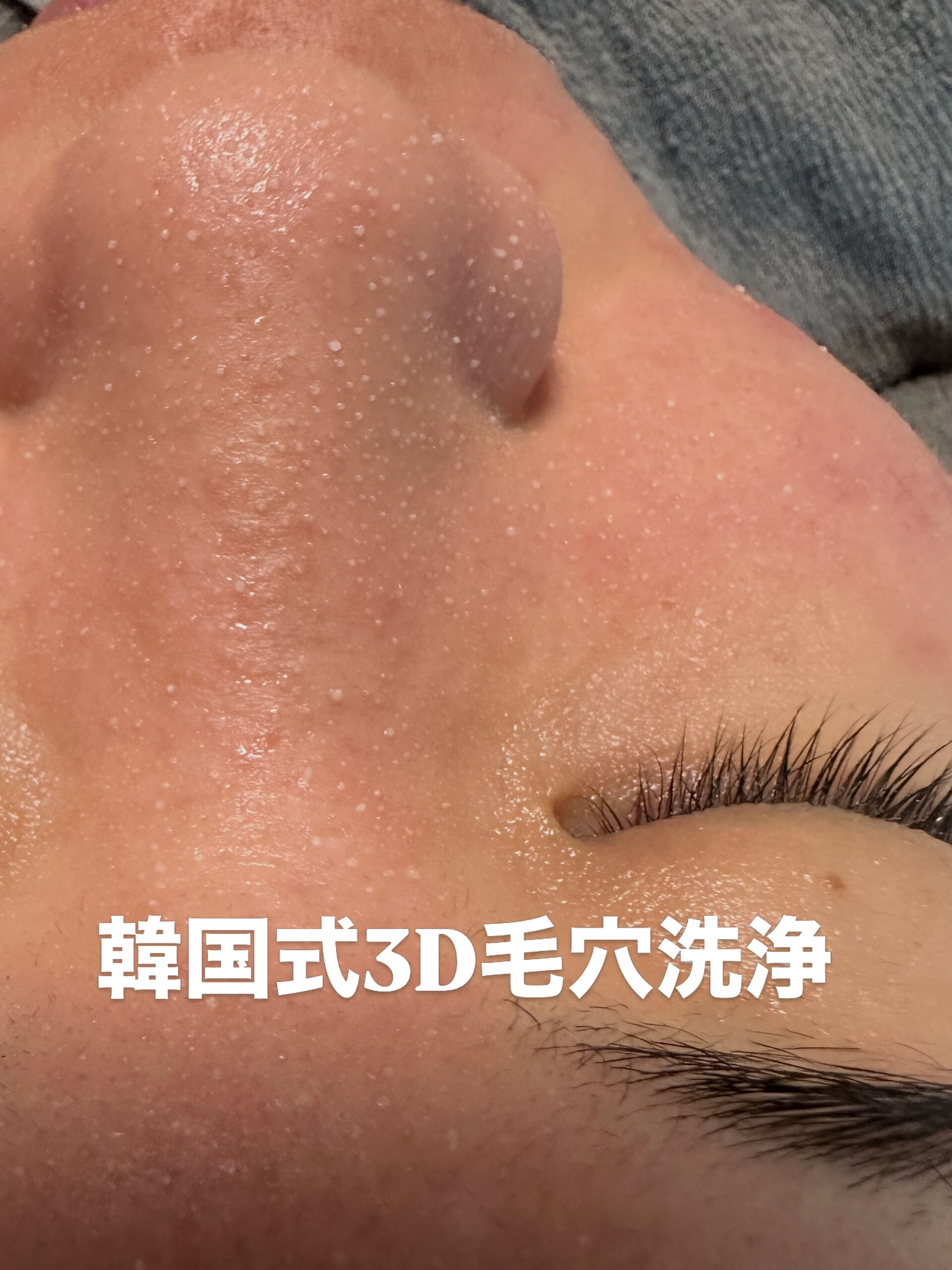 「何をしてもニキビが治らない…」