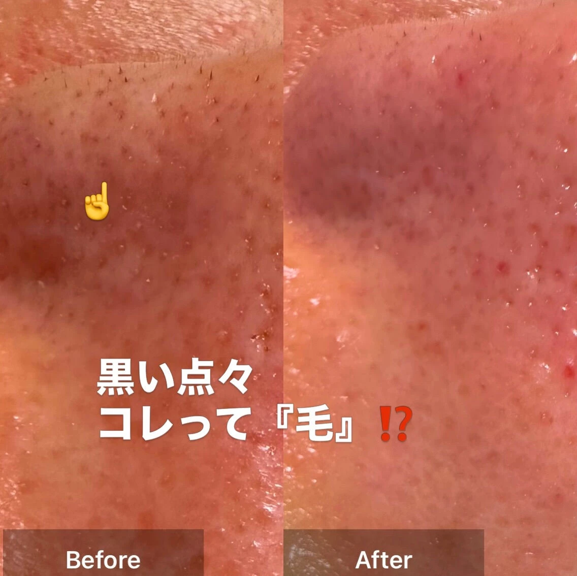 「この黒い点々が気になるんです…」
