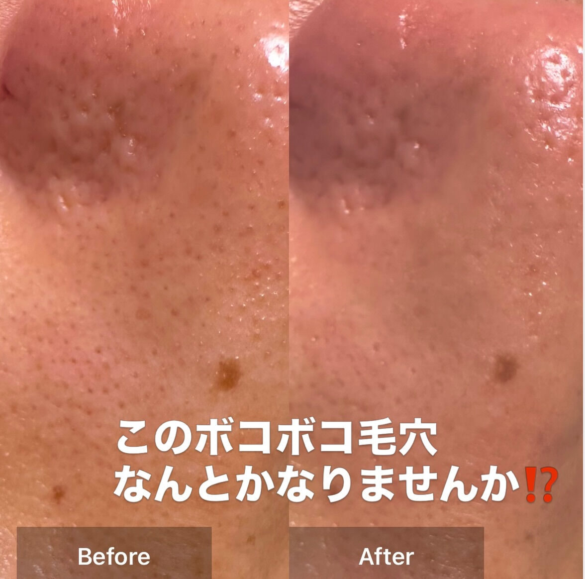 「ハイドラを何度か受けたけど、正直よく分からなかった」