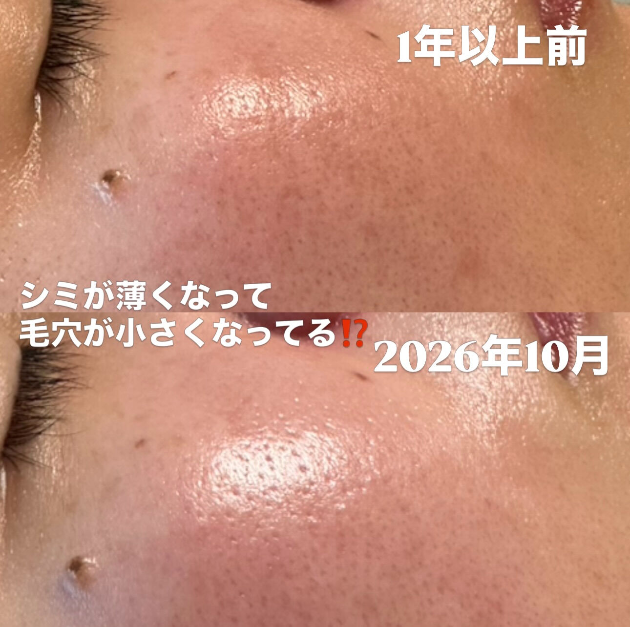 「1年以上前の肌と、今の肌