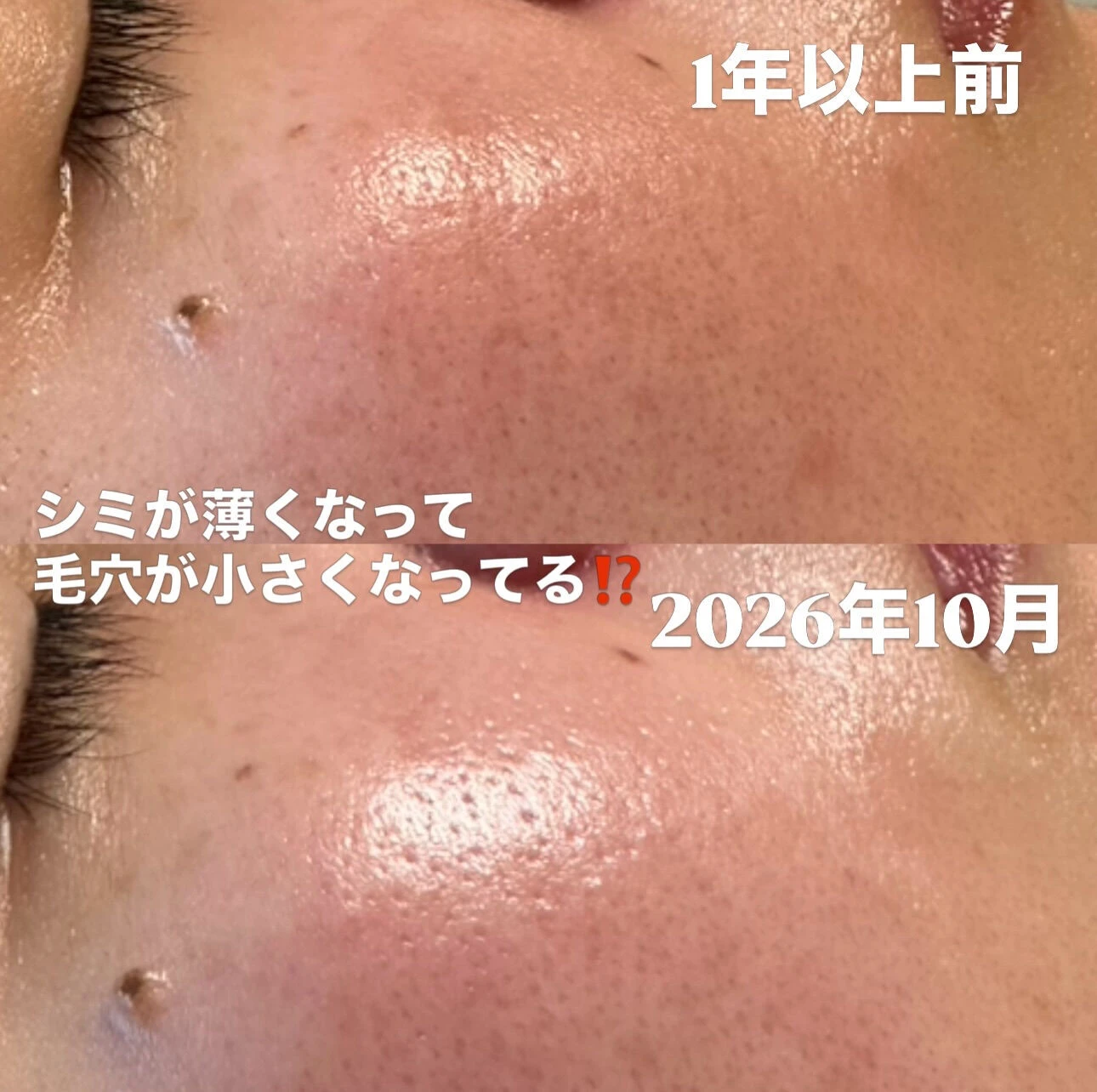 「1年以上前の肌と、今の肌
