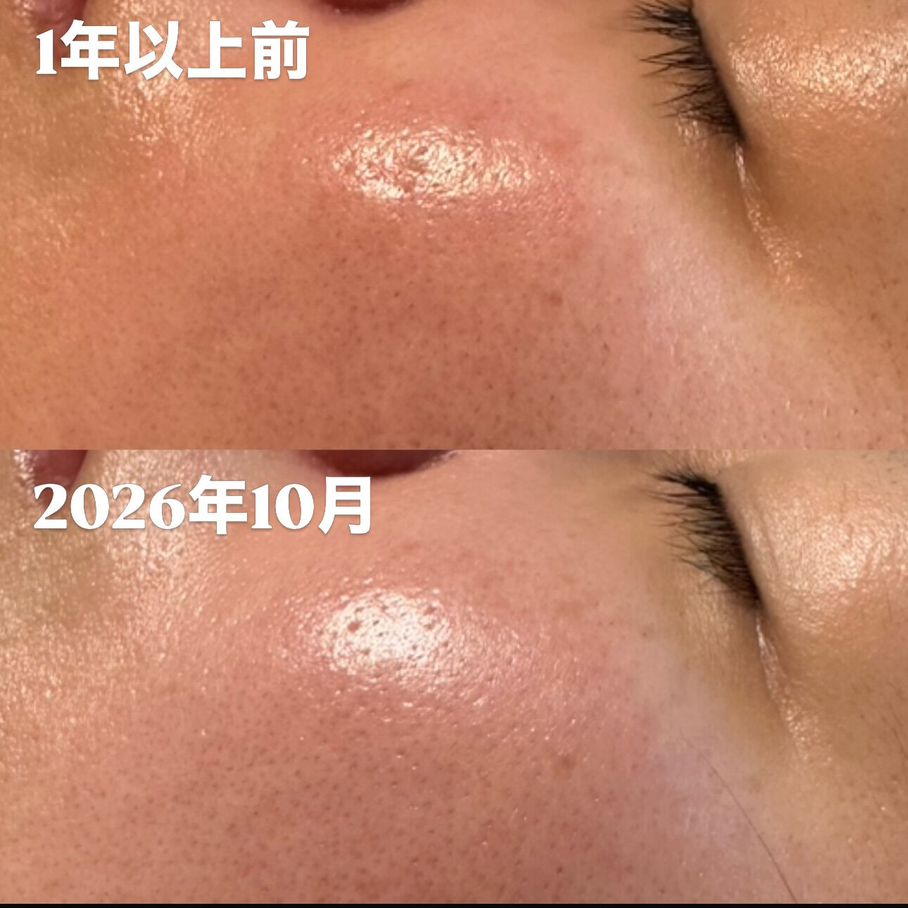 「1年以上前の肌と、今の肌