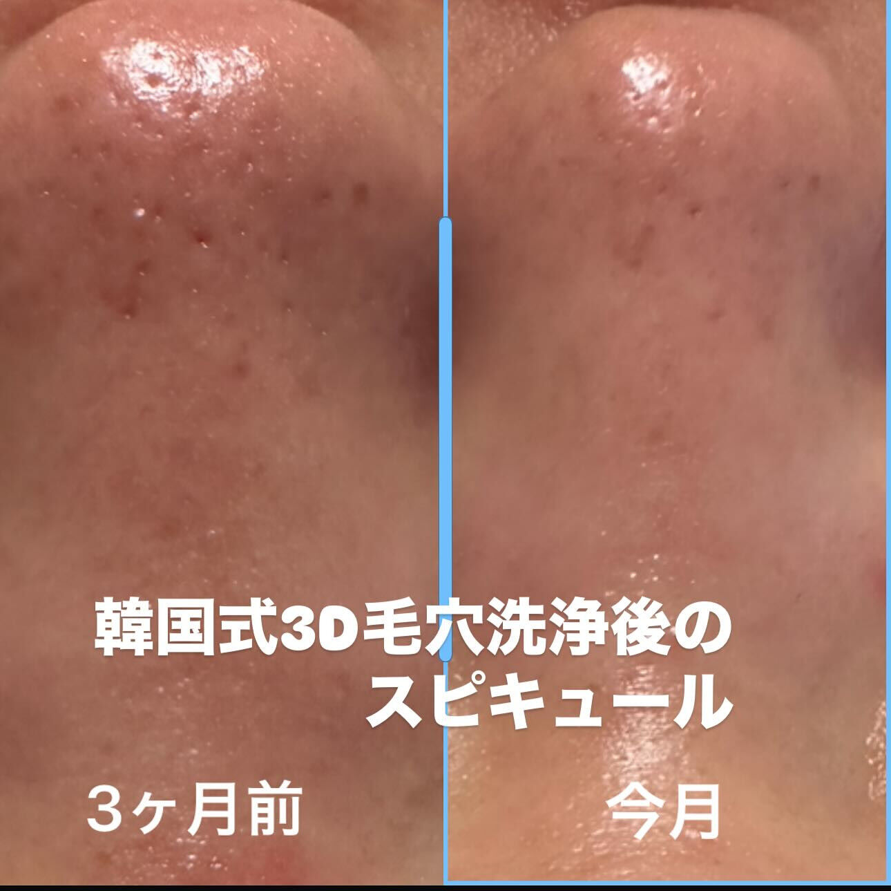 たった3ヶ月でこんなにも違う⁉️