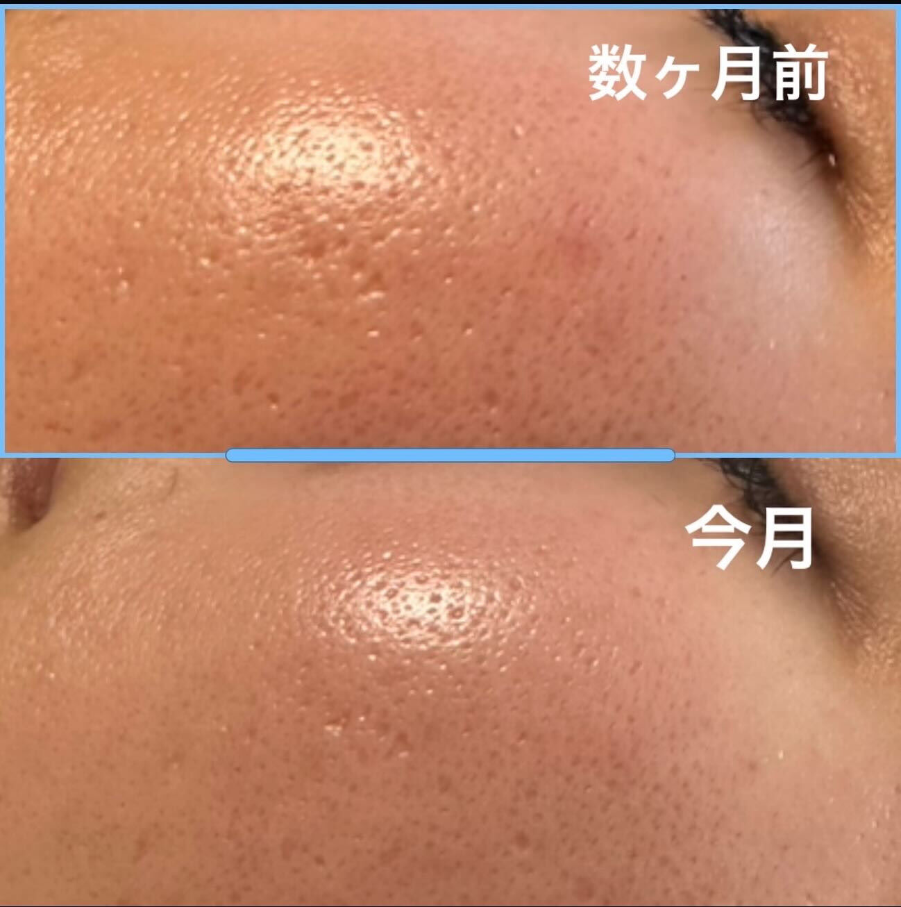 こんなにも変わっている⁉️