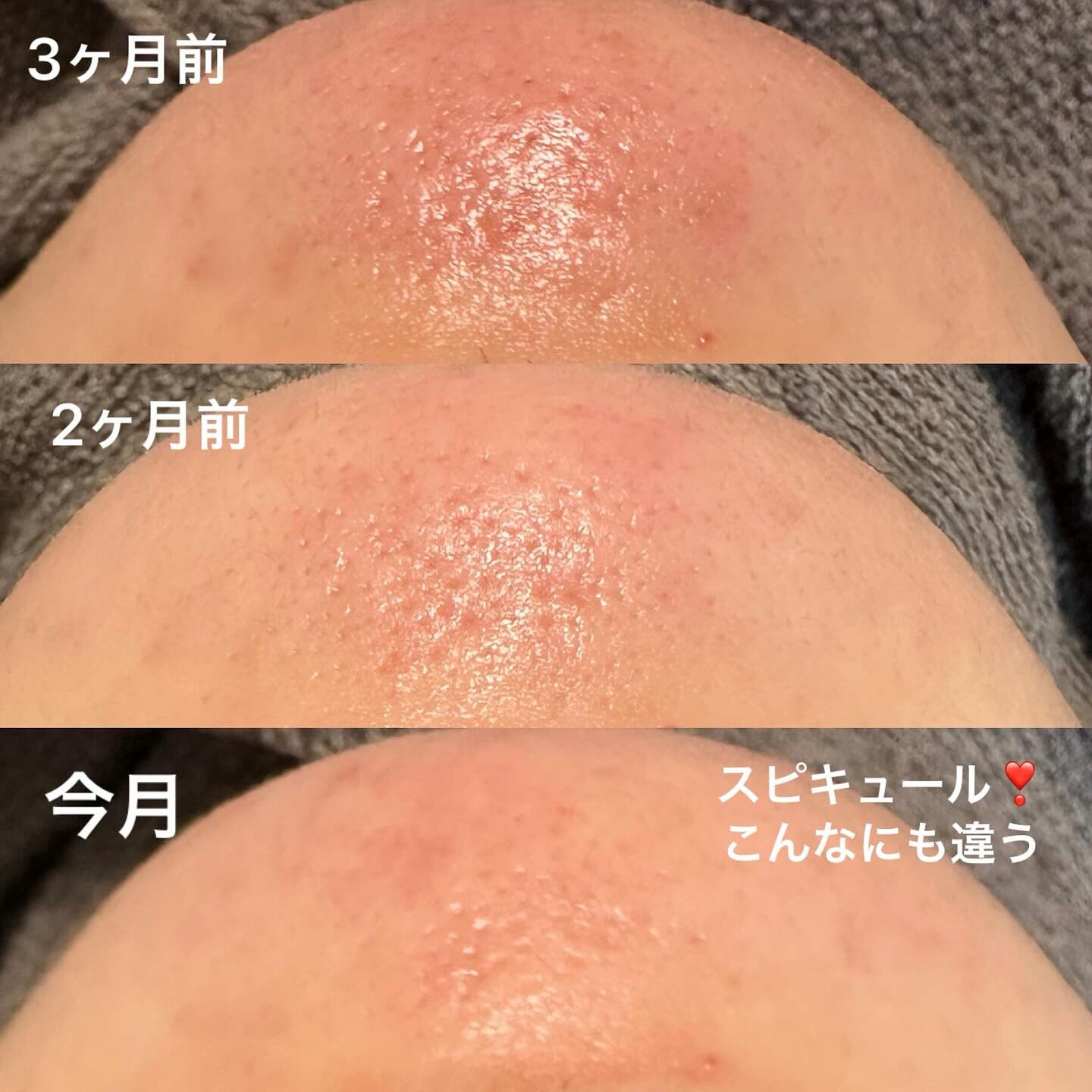 ✨こんにちは、ビューティー愛好家の皆さん！✨Sugar+K 