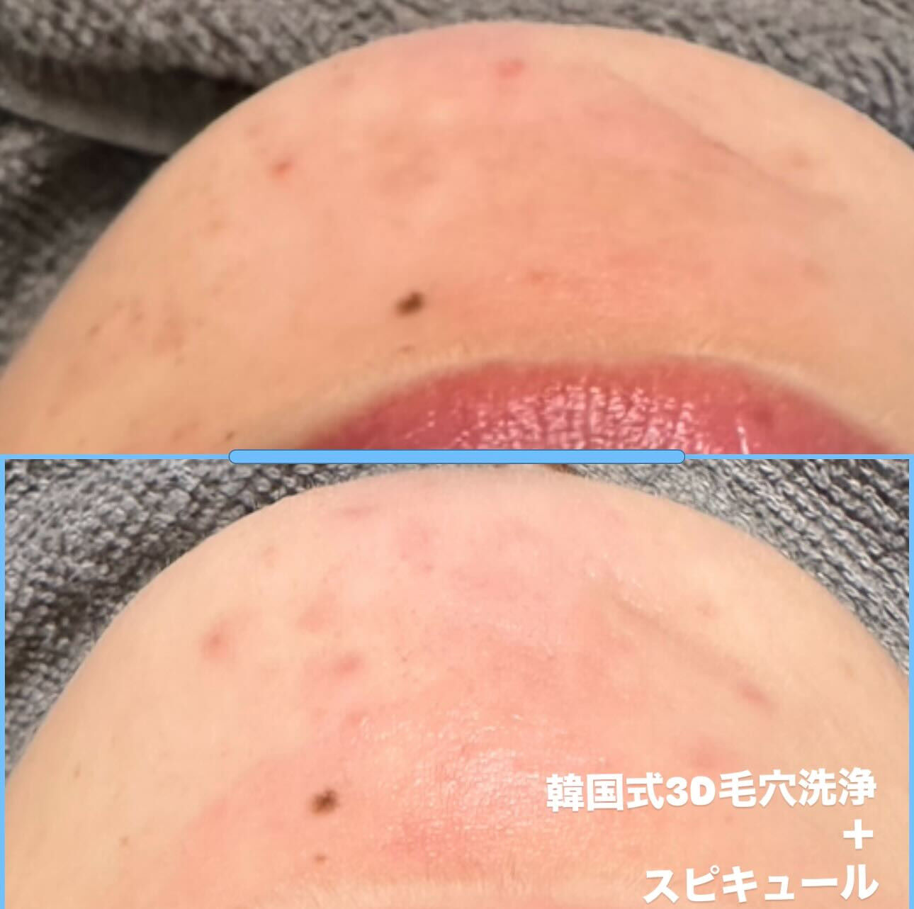 数ヶ月で⁉️