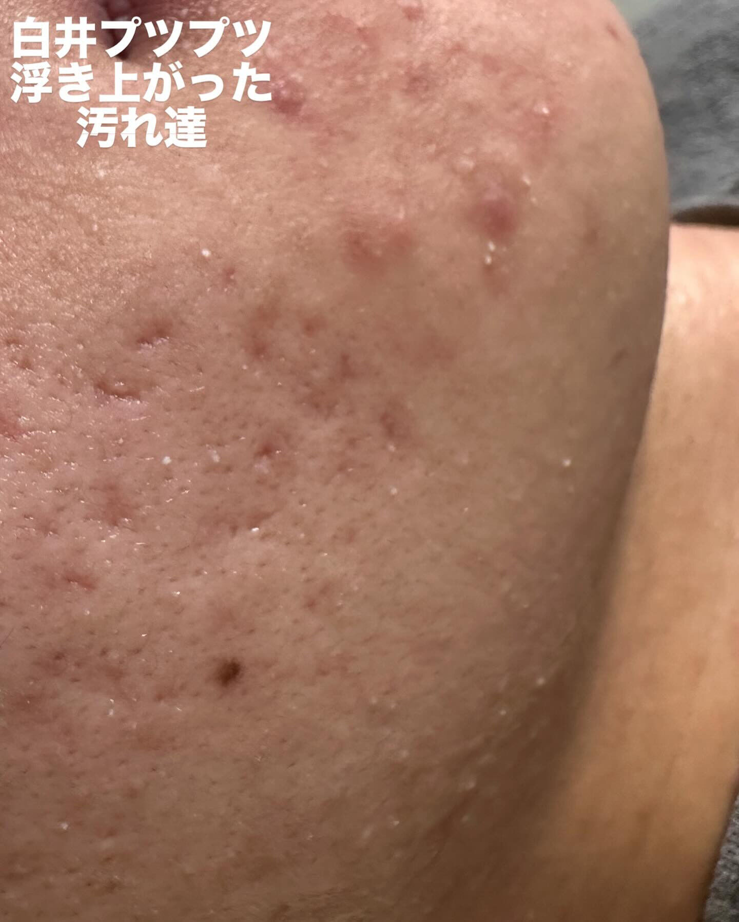 ✨かなり出てます‼️ 
