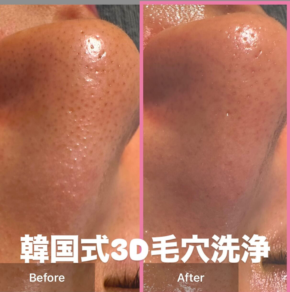 輝く素肌を今すぐ手に入れませんか？✨