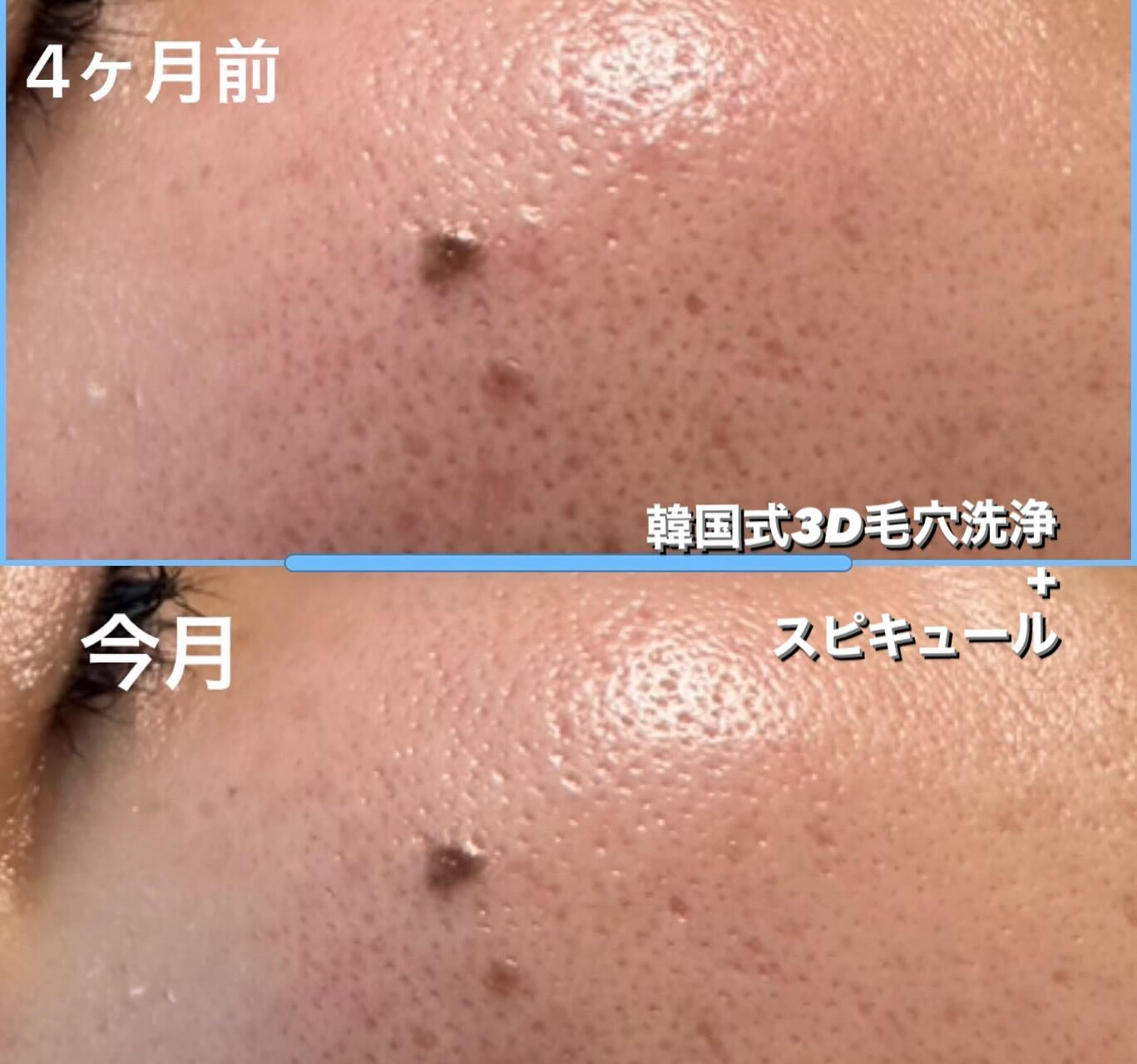 ✨お肌の変化にびっくりされたことはありますか？✨
