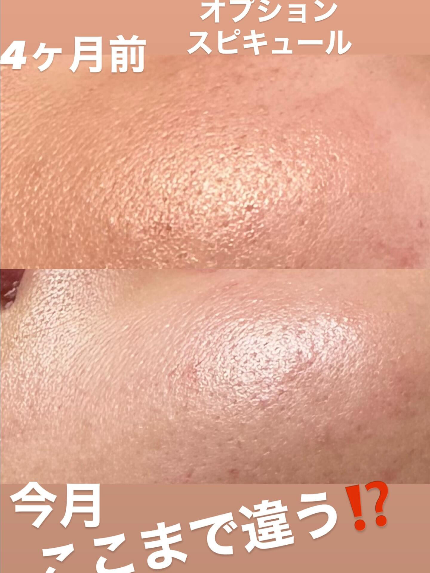 ✨ 顔が変われば毎日が変わる！✨
