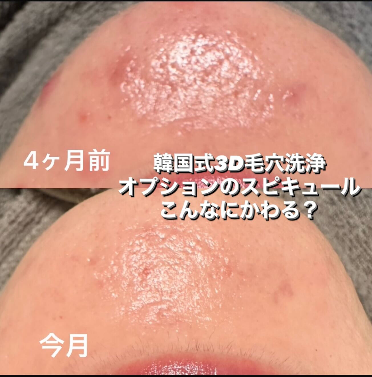 4ヶ月前と比べたら？