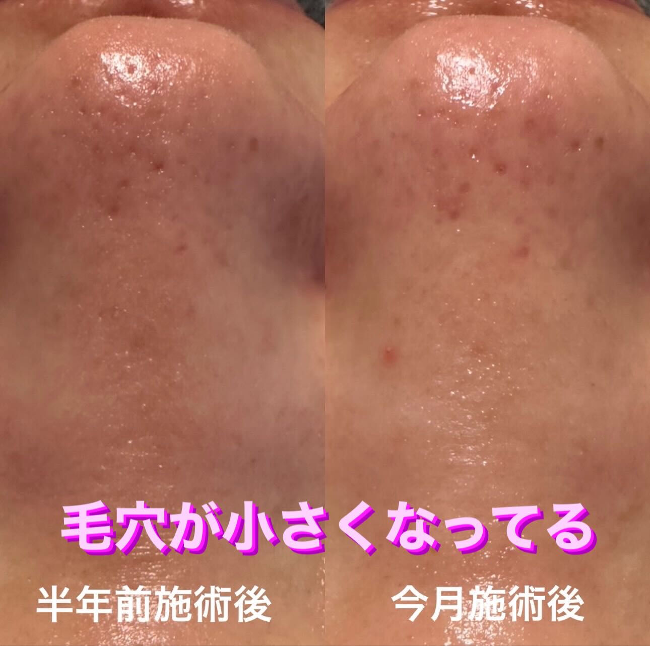 ✨🌿ビフォー＆アフターの驚き！✨ 