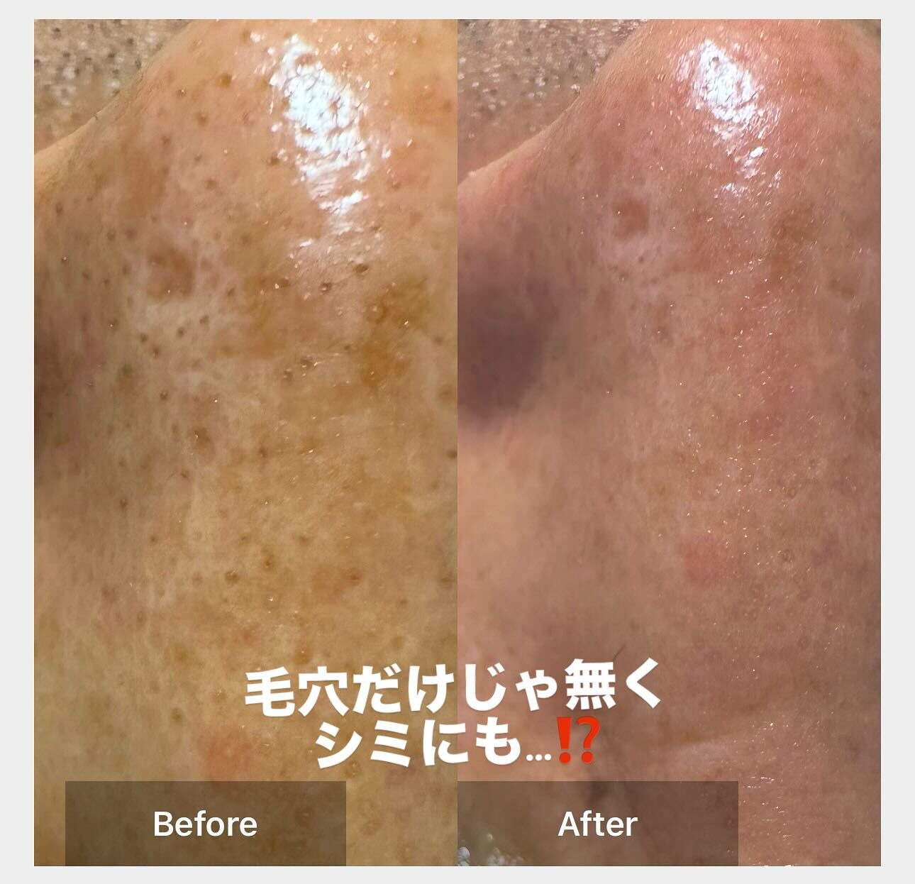 50代になっても美しさにこだわりたい…そんな方に朗報です！✨