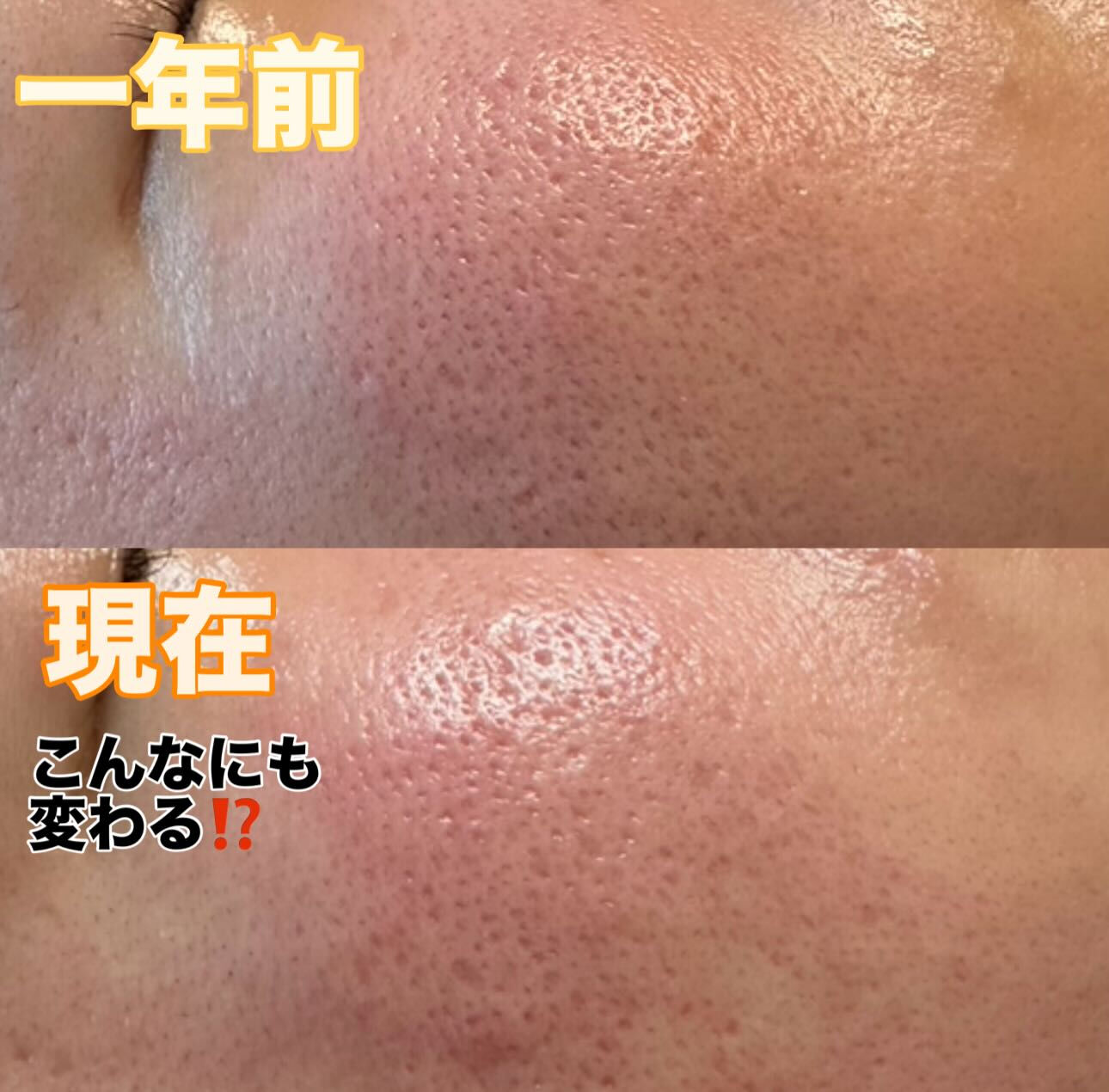 一年前と比べたら⁉️