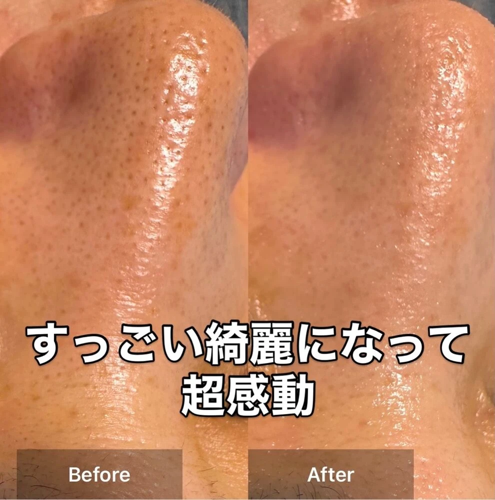画像9898